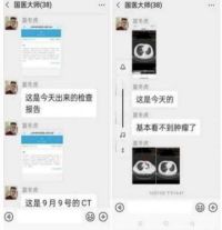 中国著名针灸专家治疗肿瘤第 一 人——陈吉香