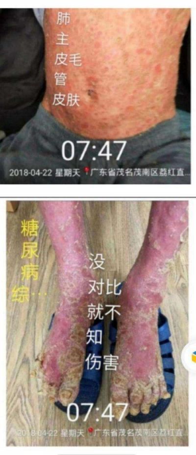 传统中医的理论与实践——周培富