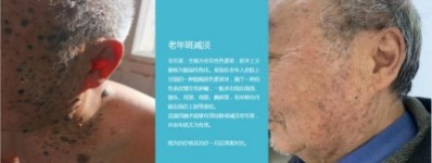 永球适温消融技术创始人  ——宁永球院长