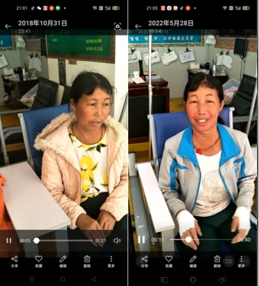 痛风结石老鼠疮乳腺增生无效退款 广西百色杨忠雅医师