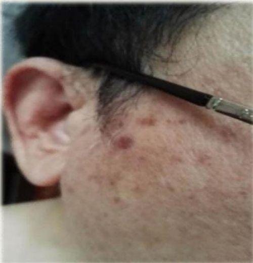 特别报道量子氢氧健康第一人长寿哥(廖永贵) 让科学量氢氧品牌走向世界!
