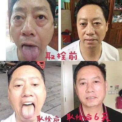 精勤不倦克顽疾 博极医源扬中医 功勋国医 · 当代楷模 中医药传承创新模范人物—盛国轩