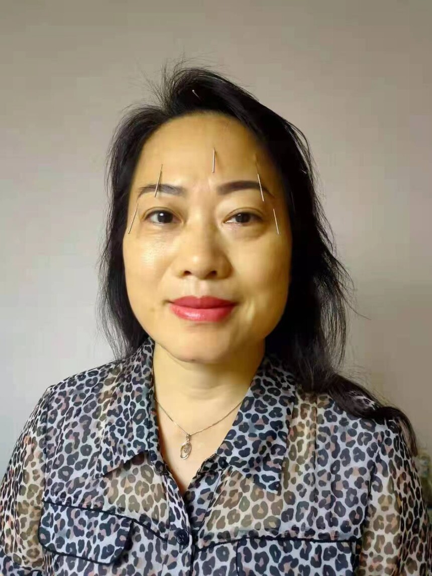 最美名中医—— 施发兴