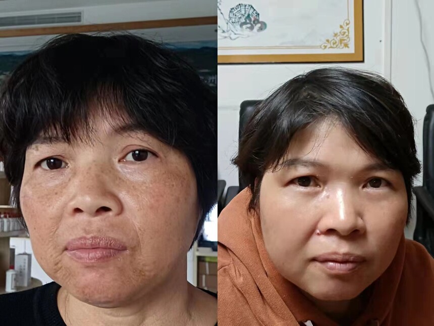 最美名中医—— 施发兴