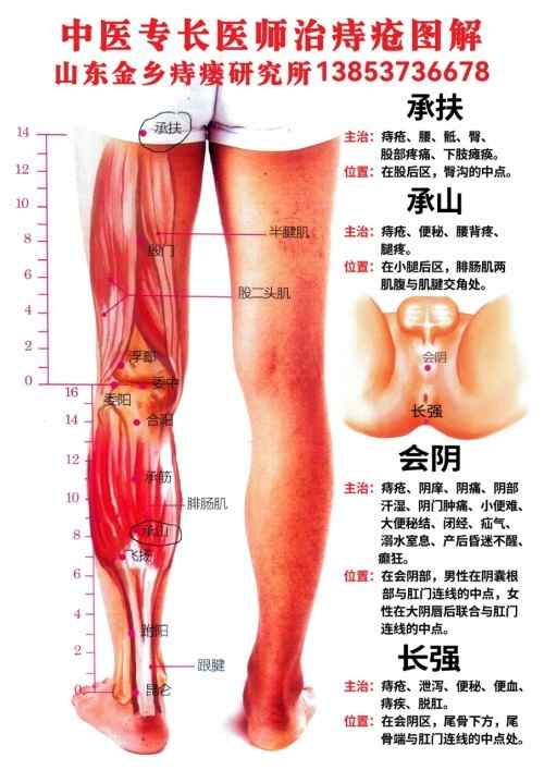 传承中医药文化 金乡县痔瘘研究所所长——戴继杭
