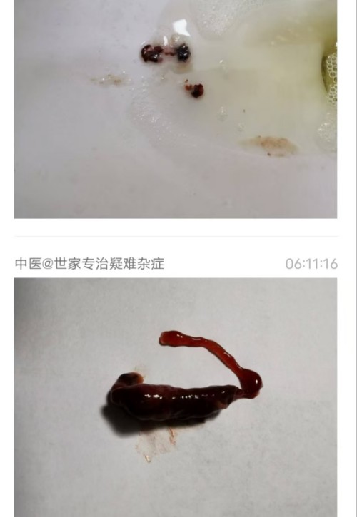 红墙御医胡维勤的传承人——黎化雨