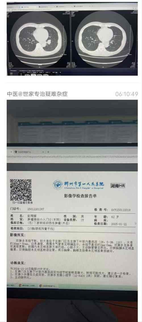 红墙御医胡维勤的传承人——黎化雨