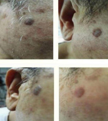 量子氢氧 健康第一人长寿哥(廖永贵) 让科学量氢氧品牌走向世界!