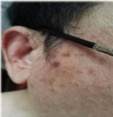 量子氢氧 健康第一人长寿哥(廖永贵) 让科学量氢氧品牌走向世界!