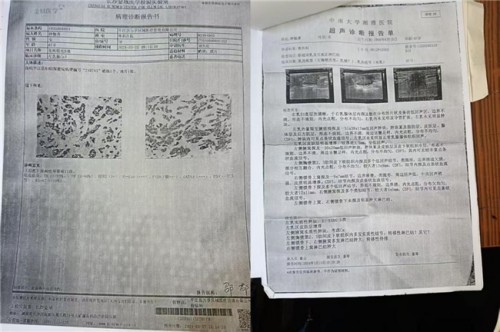 陈海林教授三焦气化法：开创乳腺癌治疗新路径