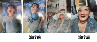 资深中医针灸传承人——胡硕清