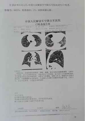 中医药根治新冠肺炎是当代人类医学发展的必然选择！