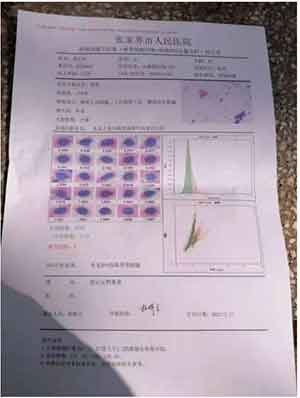 彰显中国榜样 时代楷模 中国著名针灸专家 治疗肿瘤第一人——陈吉香